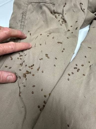 شپش روی لباس